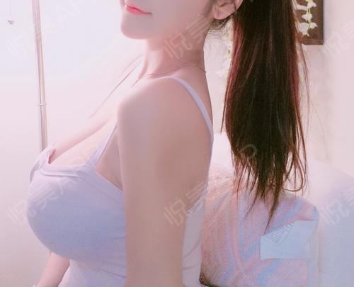 假体隆胸术后37天_隆胸术后37天_胸部术后37天_宇宙无敌超级美少女