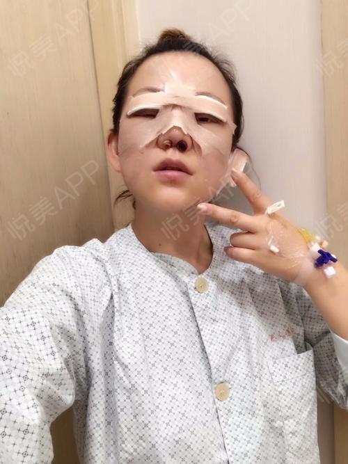 小仙女要开始写日记了,各位仙女来围观,鼻子塌陷,有点驼峰鼻,找了好多