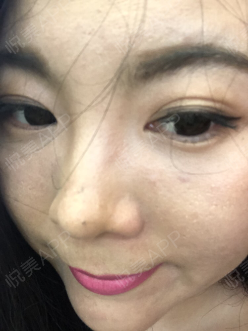 今天有事要化妆,前两张是轻微美颜,后两张是苹果x原版前摄像头.